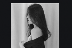 西安小白兔口腔醫(yī)院閆慧娟整形價(jià)格表附牙齒陶瓷矯正案例展示