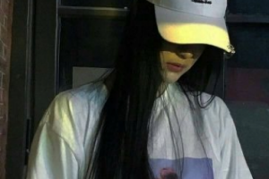 西安小白兔口腔醫(yī)院劉曉娟整形價(jià)格表附牙齒隱形矯正案例展示