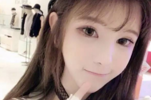 西安普瑞眼科醫(yī)院張永康整形價(jià)格表附切開雙眼皮案例展示