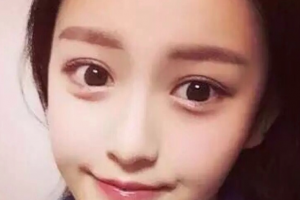 長(zhǎng)沙臻顏醫(yī)療美容門(mén)診部張浩整形價(jià)格表附激光祛斑案例展示