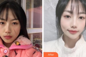 阜陽(yáng)楊鈞美容整形門(mén)診部楊鈞整形價(jià)格表附祛疤案例展示