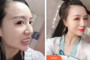 阜陽愛齒口腔門診部彭博整形價格表附牙齒隱形矯正案例展示