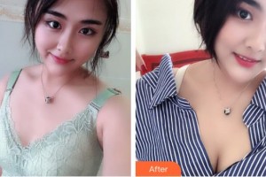 宿州天使醫(yī)療美容門(mén)診部路宏波整形價(jià)格表附隆胸案例展示