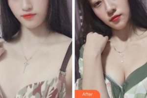 宿州康麗醫(yī)療美容門(mén)診部季輝整形價(jià)格表附豐胸案例展示