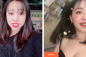 宿州愛(ài)牙口腔醫(yī)院韓宇順整形價(jià)格表附口腔矯正案例展示