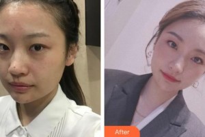 巢湖麗膚中西醫(yī)結(jié)合門(mén)診部醫(yī)療美容科馮舸整形價(jià)格表附祛斑案例展示