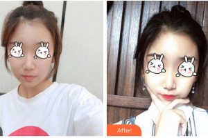 六安嘉秀醫(yī)療美容門(mén)診部翁上喬整形價(jià)格表附光子嫩膚案例展示