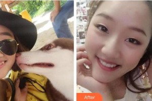 六安竹子口腔醫(yī)院王憲順整形價(jià)格表附牙齒隱形矯正案例展示