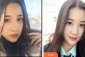 六安艾雯口腔門(mén)診劉瑜整形價(jià)格表附冷光美白案例展示