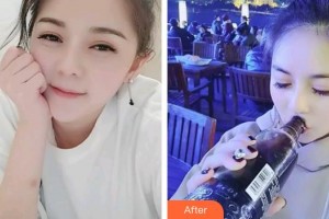 池州肖學(xué)忠口腔診所肖學(xué)忠整形價格表附冷光美白案例展示