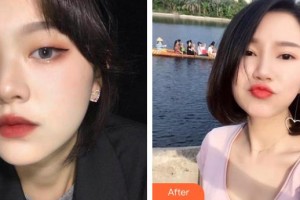 宣城康視五官科醫(yī)院眼科雷天晴整形價(jià)格表附眼部綜合案例展示