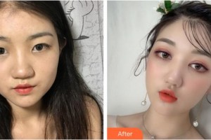 宣城康視五官科醫(yī)院眼科劉碧泉整形價(jià)格表附眼部綜合案例展示