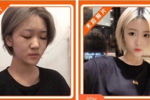 浙江大學(xué)醫(yī)學(xué)院附屬第二醫(yī)院整形科許鳳芝整形價格表附鼻部綜合案例展示