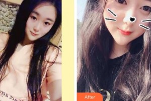 浙江大學(xué)醫(yī)學(xué)院附屬口腔醫(yī)院朱海華整形價格表附美白劑美白牙齒案例展示