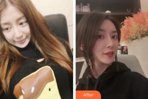 杭州華山連天美醫(yī)療美容整形醫(yī)院金鐘瑞整形價格表附鼻部整形案例展示