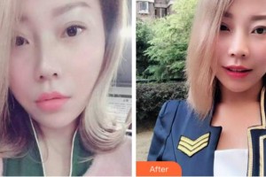 杭州華山連天美醫(yī)療美容整形醫(yī)院吳國興整形價格表附牙齒隱形矯正案例展示