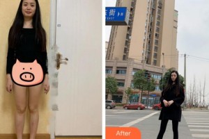 杭州新友好整形醫(yī)院張智云整形價格表附吸脂瘦大腿案例展示