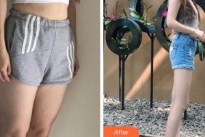 杭州新友好整形醫(yī)院韓再始整形價格表附吸脂瘦大腿案例展示