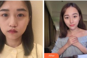 杭州東方整形外科門診部姜頌期整形價格表附抗衰老案例展示