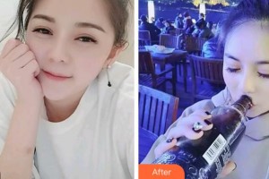 杭州愛琴海醫(yī)療美容醫(yī)院陸敏整形價(jià)格表附冷光美白案例展示