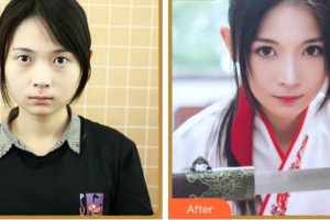 杭州朝聚眼科醫(yī)院張?chǎng)握蝺r(jià)格表附眼部綜合案例展示