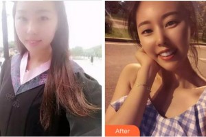 杭州牙科醫(yī)院石紅兵整形價(jià)格表附牙齒陶瓷矯正案例展示