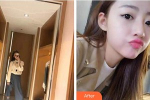 杭州品凱口腔醫(yī)院黃劍奇整形價(jià)格表附牙齒隱形矯正案例展示