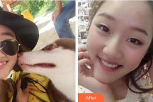 杭州博凡口腔門診部張弘整形價格表附牙齒隱形矯正案例展示