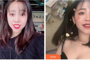 杭州博凡口腔門診部賈旭整形價格表附金屬托槽矯正案例展示