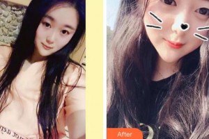 杭州西湖口腔醫(yī)院李國清整形價格表附美白劑美白牙齒案例展示