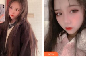 杭州愛爾眼科醫(yī)院許英整形價格表附切開雙眼皮案例展示