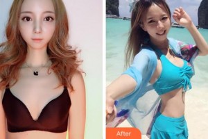 寧波珈禾整形專(zhuān)科醫(yī)院雷中元整形價(jià)格表附自體脂肪隆胸案例展示