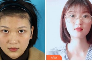 寧波藝星整形美容醫(yī)院肖慶華整形價(jià)格表附內(nèi)切祛眼袋案例展示