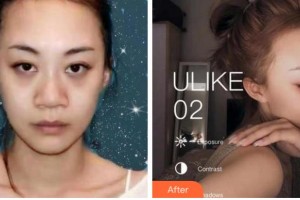 寧波煥嬌醫(yī)療美容門診部王惠梅整形價格表附鼻部綜合案例展示