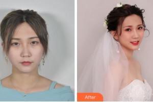 寧波胡繼來醫(yī)療美容診所黃雄飛整形價格表附眼部綜合案例展示