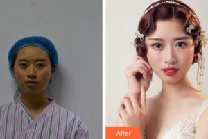 溫州藝星醫(yī)學(xué)美容醫(yī)院黃艷軍整形價(jià)格表附抗衰案例展示