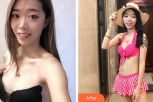 溫州醫(yī)學(xué)院附屬第一醫(yī)院整形外科趙進(jìn)軍整形價(jià)格表附自體脂肪隆胸案例展示