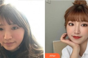 溫州解放軍118醫(yī)院整形科江婷整形價格表附激光祛斑案例展示