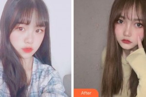 溫州芘麗芙美容醫(yī)院程軍整形價格表附開內(nèi)眼角案例展示