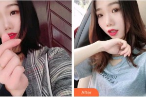 溫州王曉峰口腔醫(yī)院蘇楊整形價(jià)格表附牙齒隱形矯正案例展示