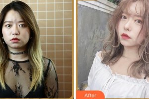 溫州醫(yī)科大學(xué)附屬眼視光醫(yī)院沈麗君整形價(jià)格表附眼部綜合案例展示