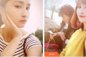 湖州金鉑利口腔門診部秦新杰整形價(jià)格表附美白貼片案例展示