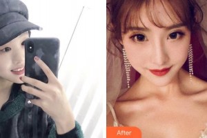 紹興華美整形美容醫(yī)院吳立群整形價格表附眼部綜合案例展示