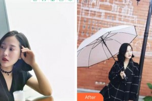 紹興德維口腔醫(yī)院劉勇整形價(jià)格表附牙貼面案例展示