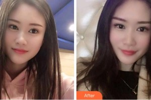 紹興越城口腔醫(yī)院孟海鋒整形價(jià)格表附冷光美白案例展示