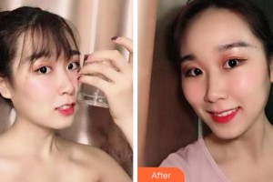 紹興柯橋口腔醫(yī)院田勝剛整形價(jià)格表附牙齒隱形矯正案例展示