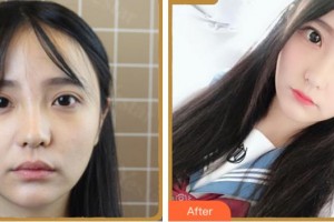 紹興愛爾眼科醫(yī)院田玉蘭整形價(jià)格表附眼部綜合案例展示