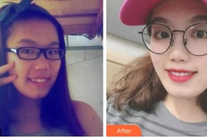 金華口腔醫(yī)院夏坤整形價格表附牙綜合案例展示