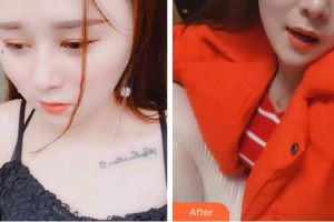 金華口腔醫(yī)院董翔整形價格表附超聲波潔牙案例展示