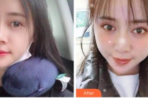 金華周亞軍口腔門診部馬永太整形價(jià)格表附自鎖托槽矯正案例展示